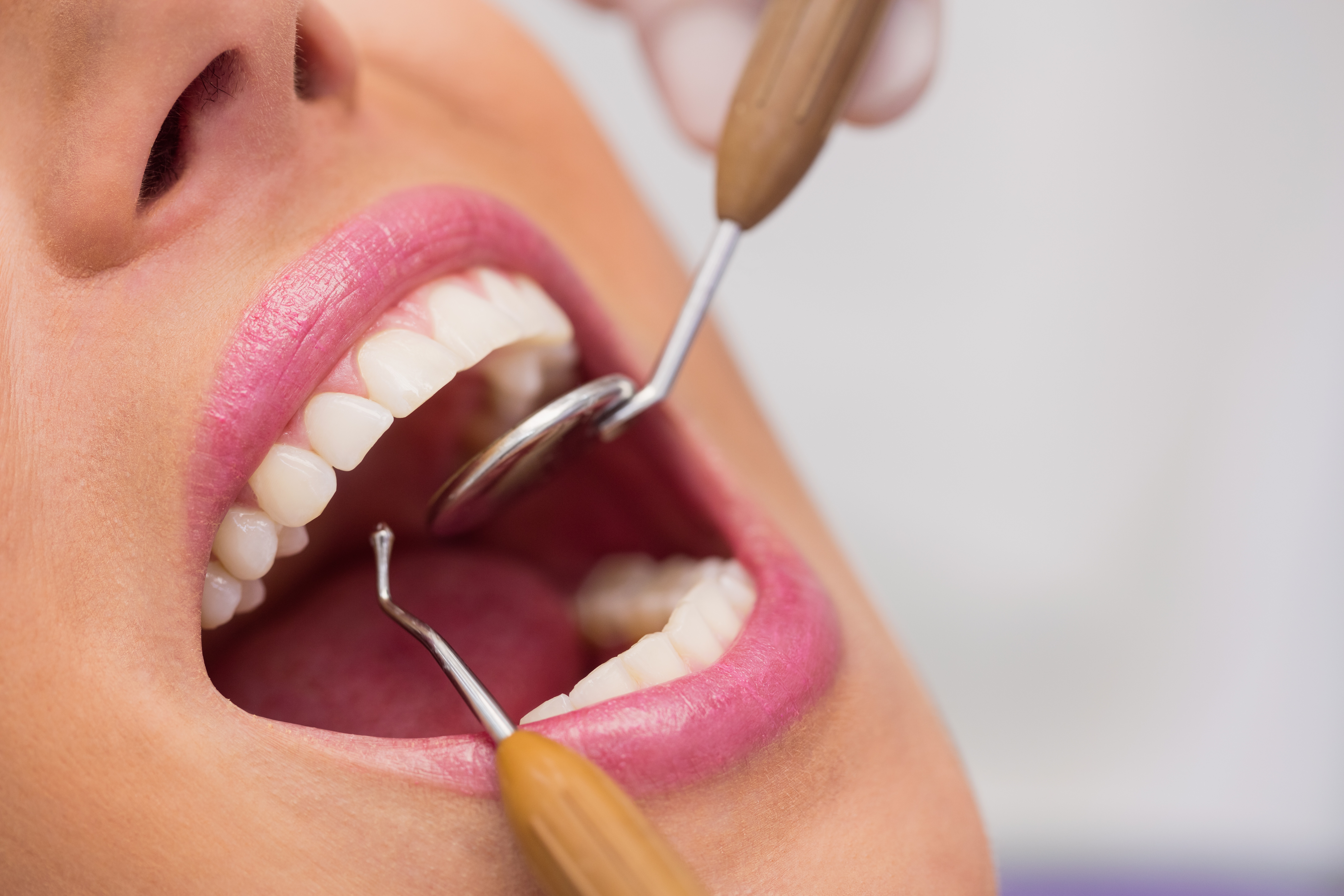 Dental crown treatment